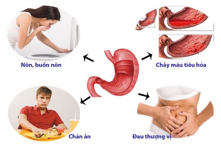 Nguyên nhân dẫn đến bệnh viêm dạ dày là gì? 1