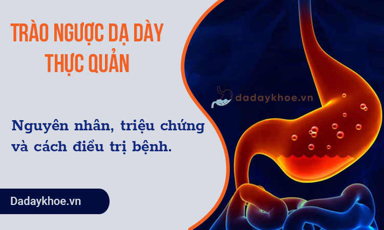 Top nguyên nhân gây trào ngược dạ dày thực quản hàng đầu