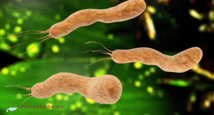 1.Vi khuẩn Helicobacter pylori (Vi khuẩn HP) 1