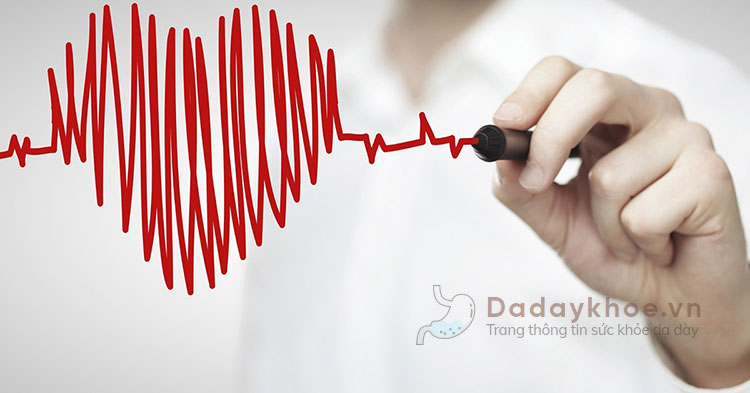 Trào ngược dạ dày có làm tim đập nhanh - Rối loạn nhịp tim không? 1