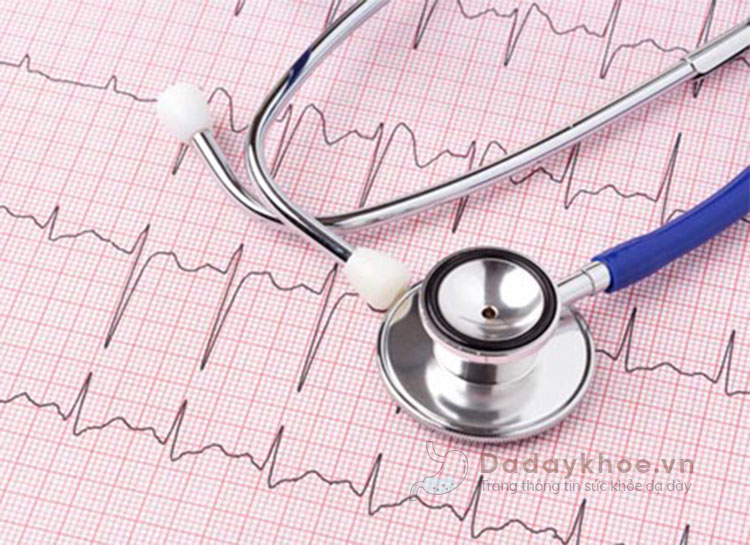 Chẩn đoán hiện tượng tim đập nhanh bằng cách nào? 1