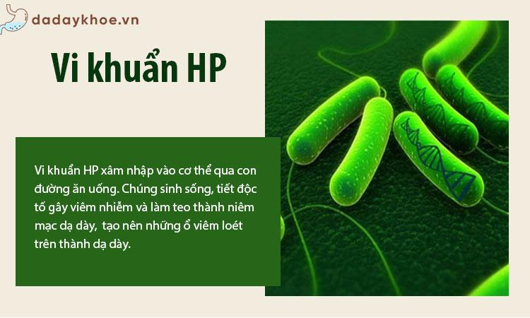 1. Do nhiễm vi khuẩn Hp (Helicobacter pylori) 1
