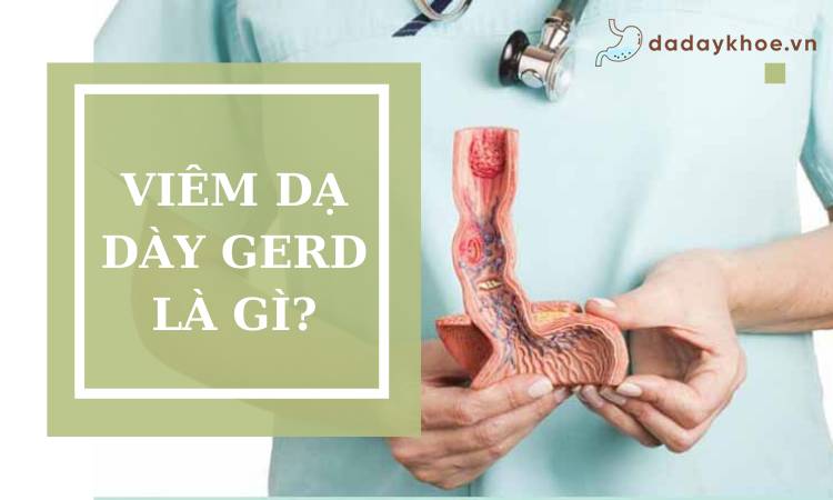 Viêm dạ dày GERD là gì? dấu hiệu và cách điều trị!