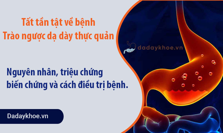 Tất tần tật về bệnh viêm loét dạ dày tá tràng